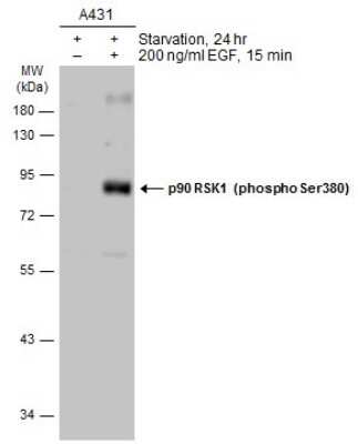Western Blot: RSK1 [p Ser380] Antibody [NBP3-13243]